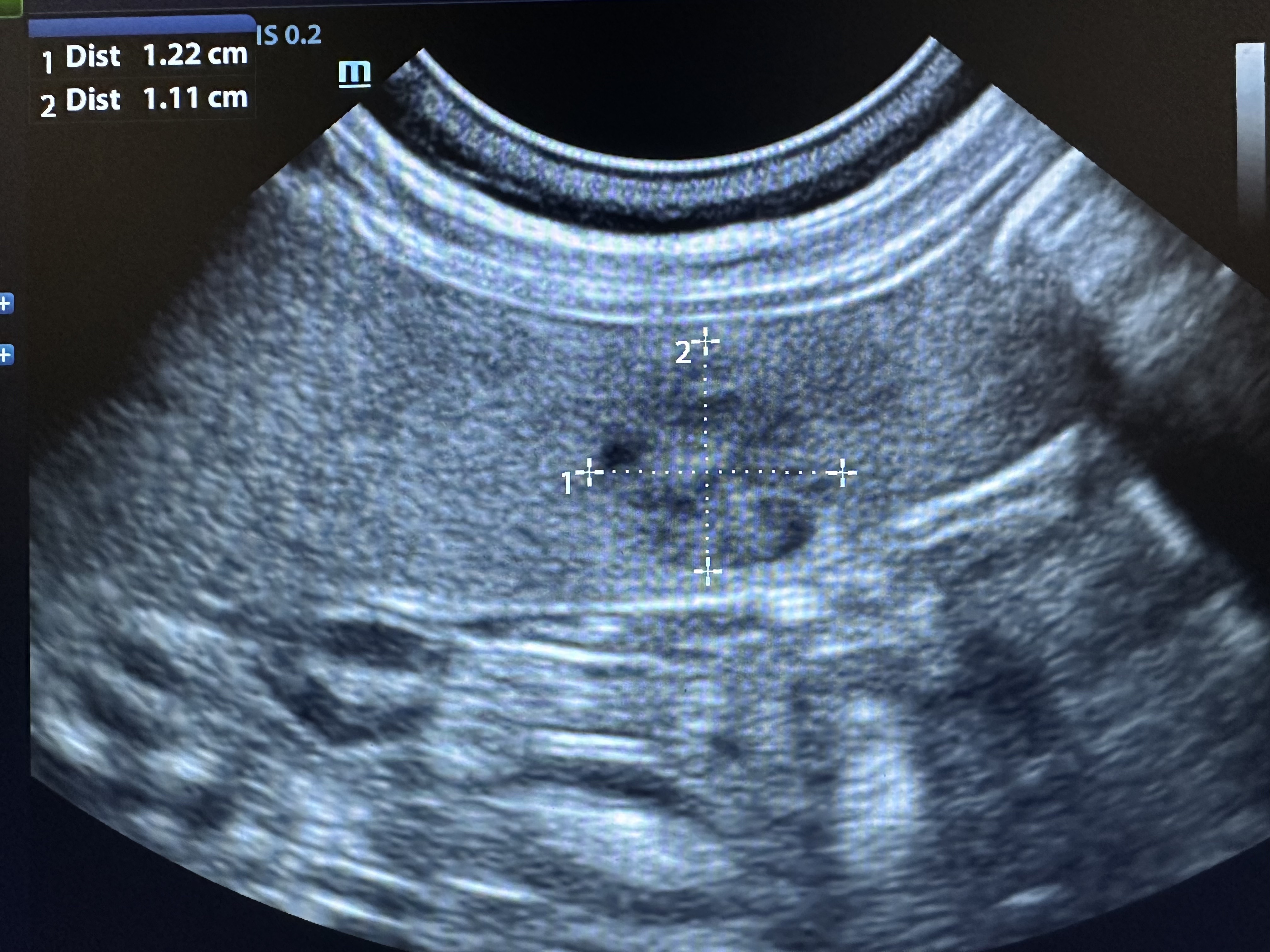 Ultrasound image of a dog's spleen
